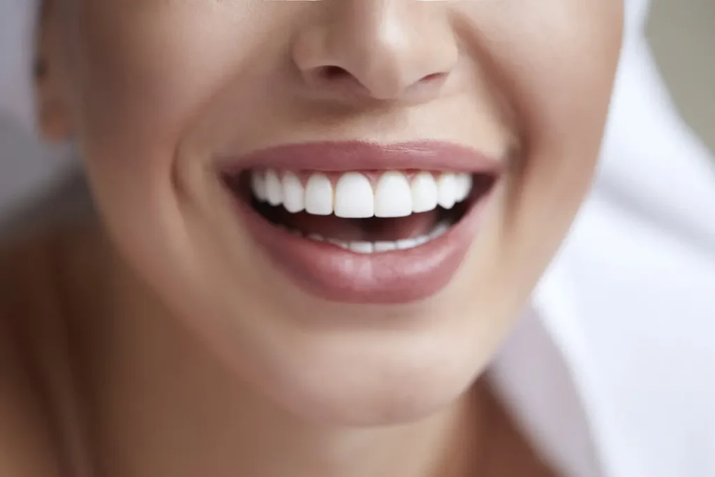 LED teeth whitening