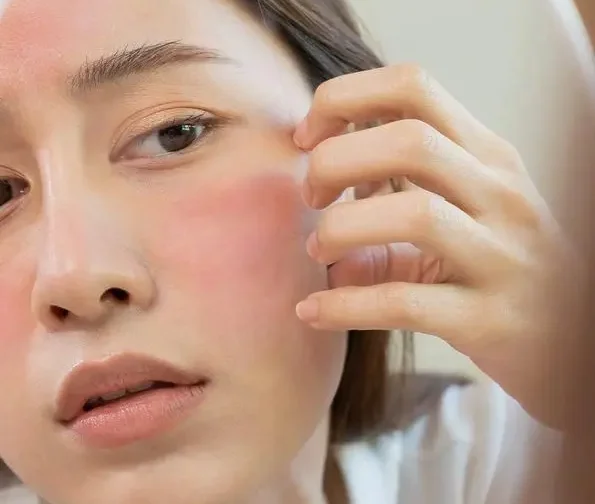 Dull and dehydrated skin in Melbourne