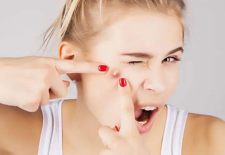 Expert skin lesion removal in Melbourne