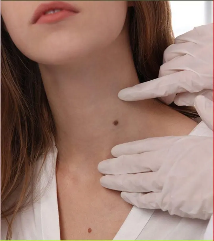 Expert skin lesion removal in Melbourne