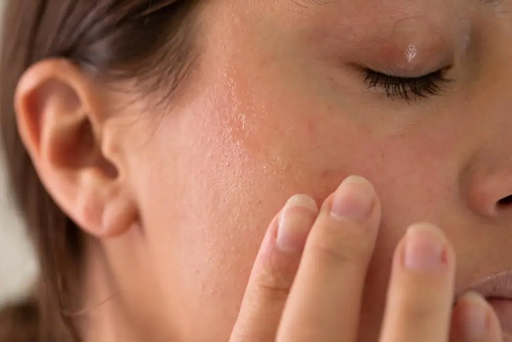 Dull and dehydrated skin in Melbourne