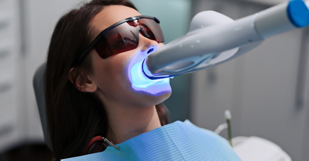 safe teeth whitening