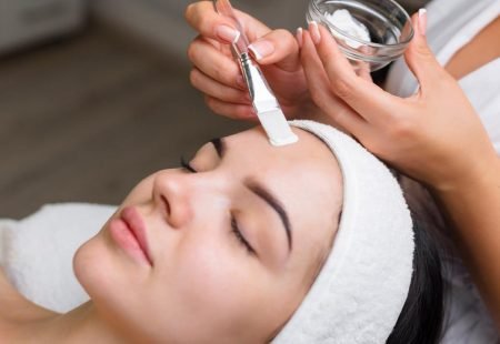 Client receiving chemical peel
