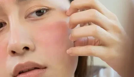 Dull and dehydrated skin in Melbourne