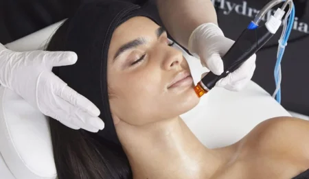 skin needling in Melbourne