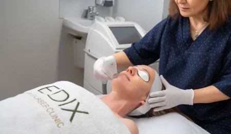 Laser pigmentation treatment