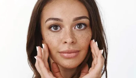 skin tag and mole removal in Melbourne