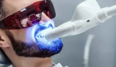 LED Teeth Whitening in Melbourne