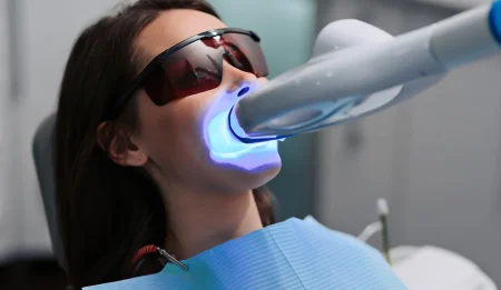 safe teeth whitening