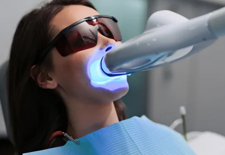 safe teeth whitening