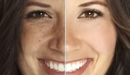 failed pigmentation treatment melbourne