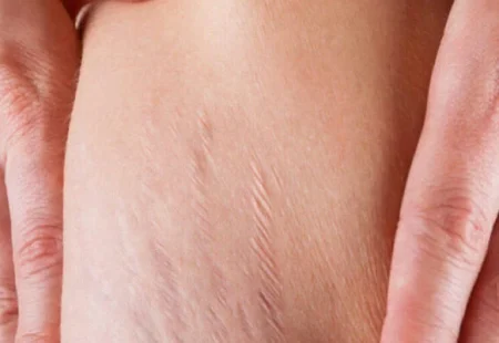 Woman,Is,Testing,The,Skin,On,His,Stomach,On,Broadly,