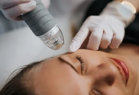 Microneedle,Rf,Lifting,In,A,Beauty,Salon.,Big,Plan.,High
