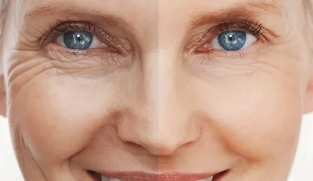 skin rejuvenation in Melbourne