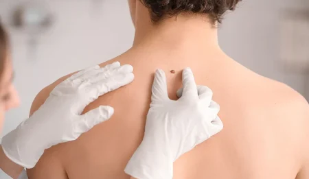 will skin tag removal leave scars